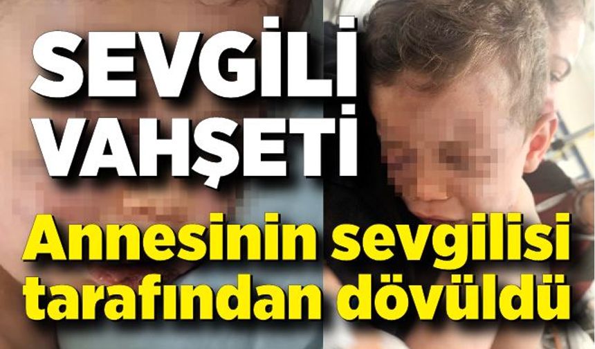 Vahşeti yaşayan 2 yaşındaki bebek hastanelik oldu; Annesinin erkek arkadaşı tarafından dövüldü