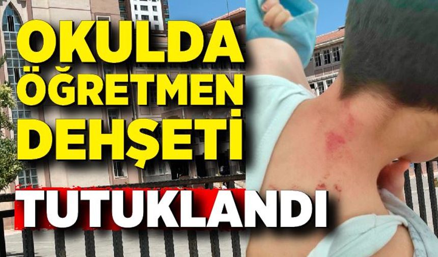 10 yaşındaki öğrencisini döven öğretmen tutuklandı