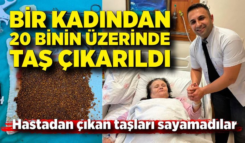 Hastadan çıkan taşları sayamadılar; Bir kadından 20 binin üzerinde taş çıkarıldı