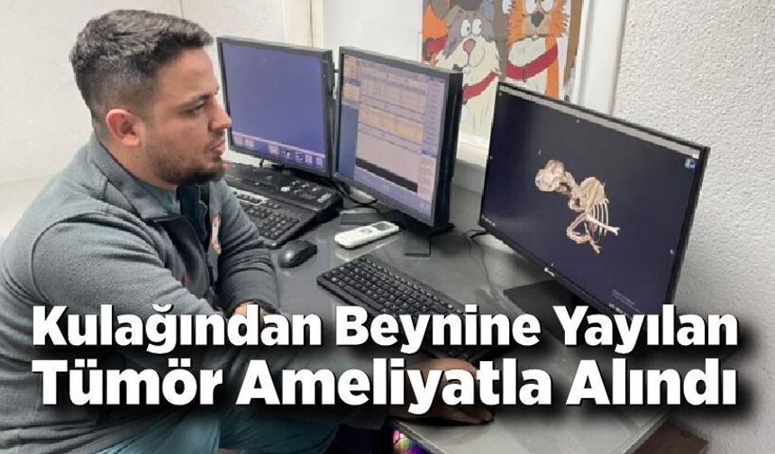 Kulağından Beynine Yayılan Tümör Ameliyatla Alındı