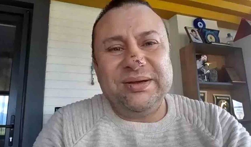 Pitbull saldırısına uğrayan Onur Akay o anları anlattı: "Ben ölümden döndüm"