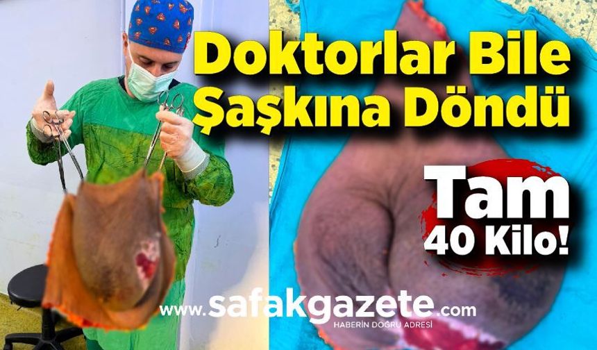 Doktorlar Bile Şaşkına Döndü: Tam 40 Kilo!