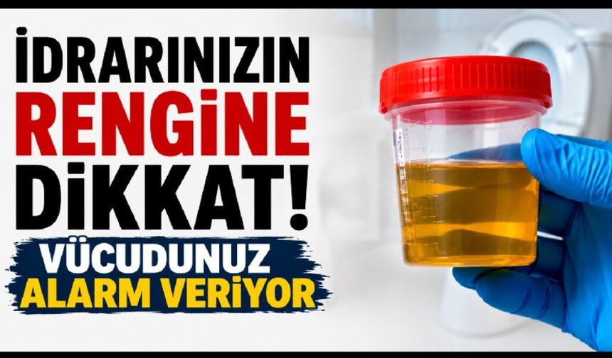 İdrarınızın Rengine Dikkat! Vücudunuz Alarm Veriyor
