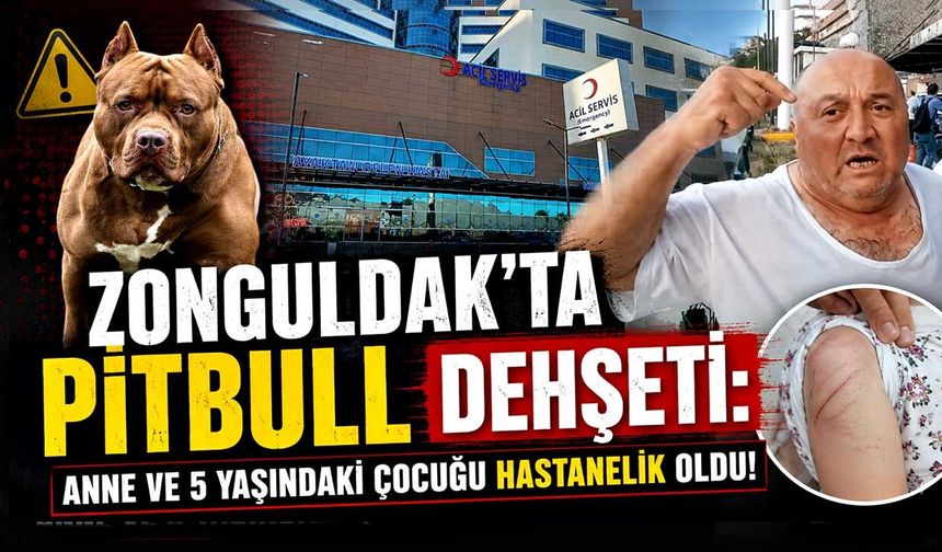 Zonguldak'ta Pitbull dehşeti: Anne ve 5 yaşındaki çocuğu hastanelik oldu!