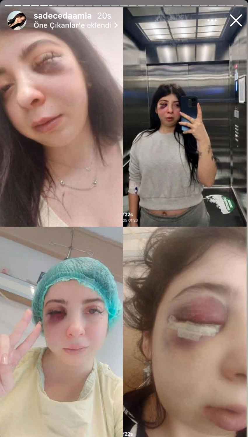 S O K A K O R T A S I N D A D A R B E D I L E N D A M L A A R T I K 600554 177741