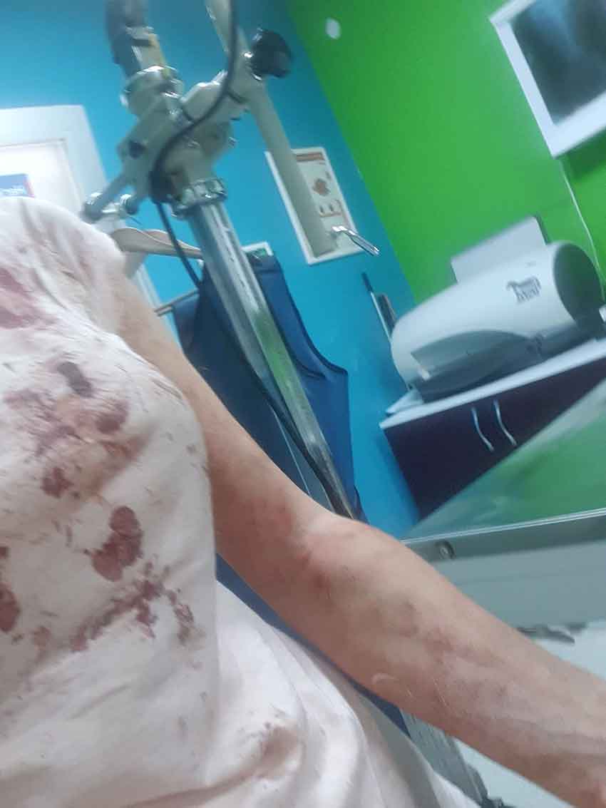 Kangal Saldırısı (2)