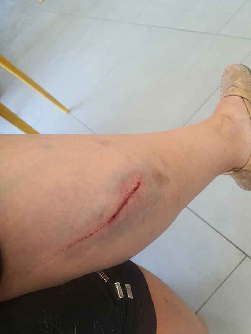 Kangal Saldırısı (3)