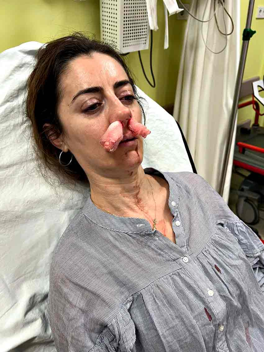 E S I N I N S E V G I L I S I S A N D I G I K A D I N I D A R B E T T I 915978 272148