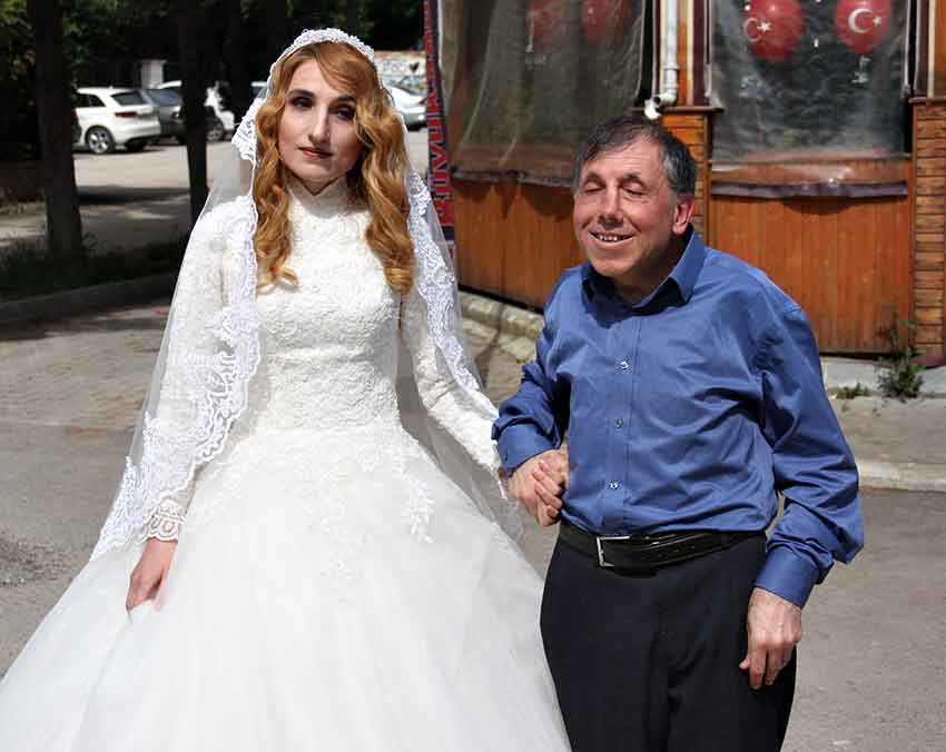 Görme Engelli̇ Çi̇fte Otobüs Çarpti (1)