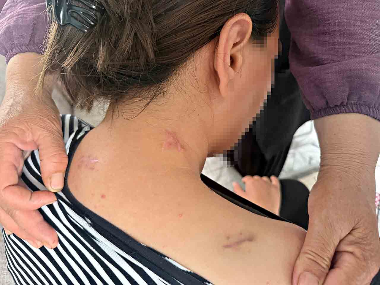 17 Bıçak Darbesi Aldı (2)