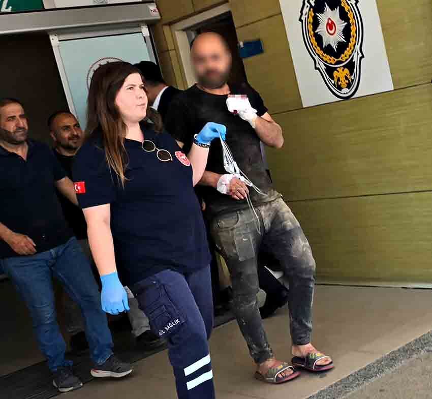 Elini Makineye Kaptıran Işçinin Parmağı Koptu (2)