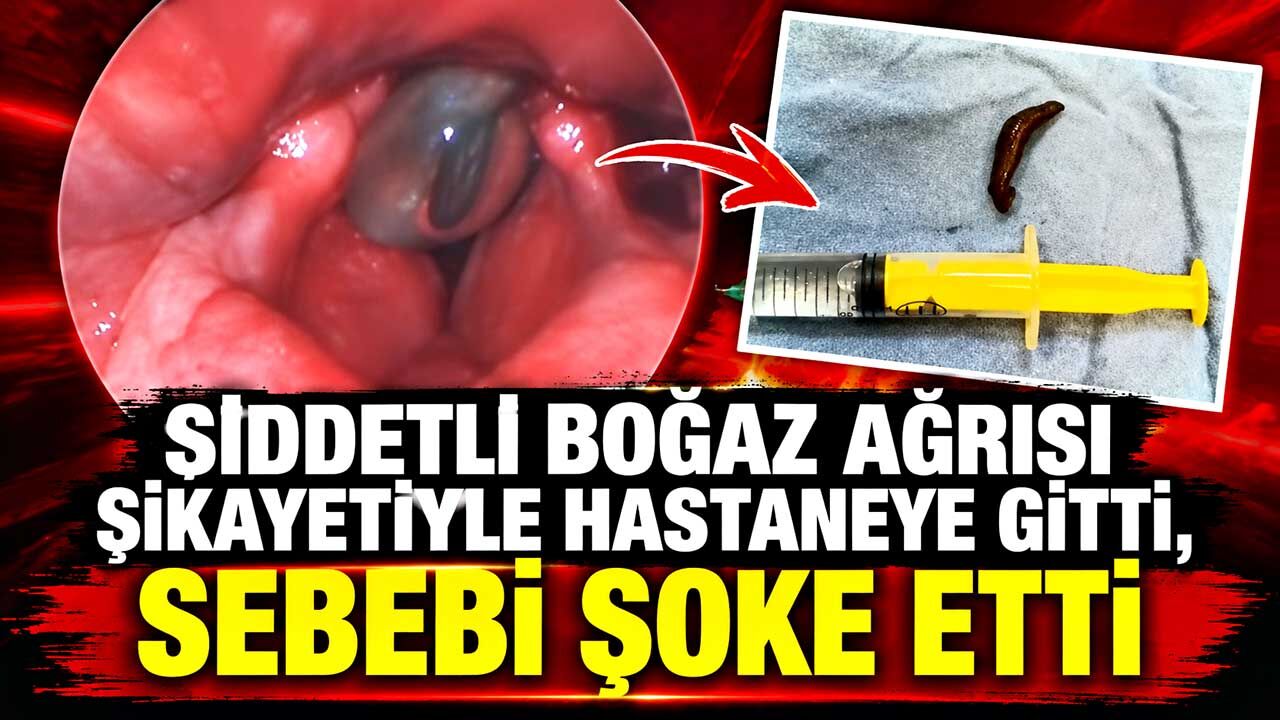 Şiddetli boğaz ağrısı şikayetiyle hastaneye gitti, sebebi şoke etti