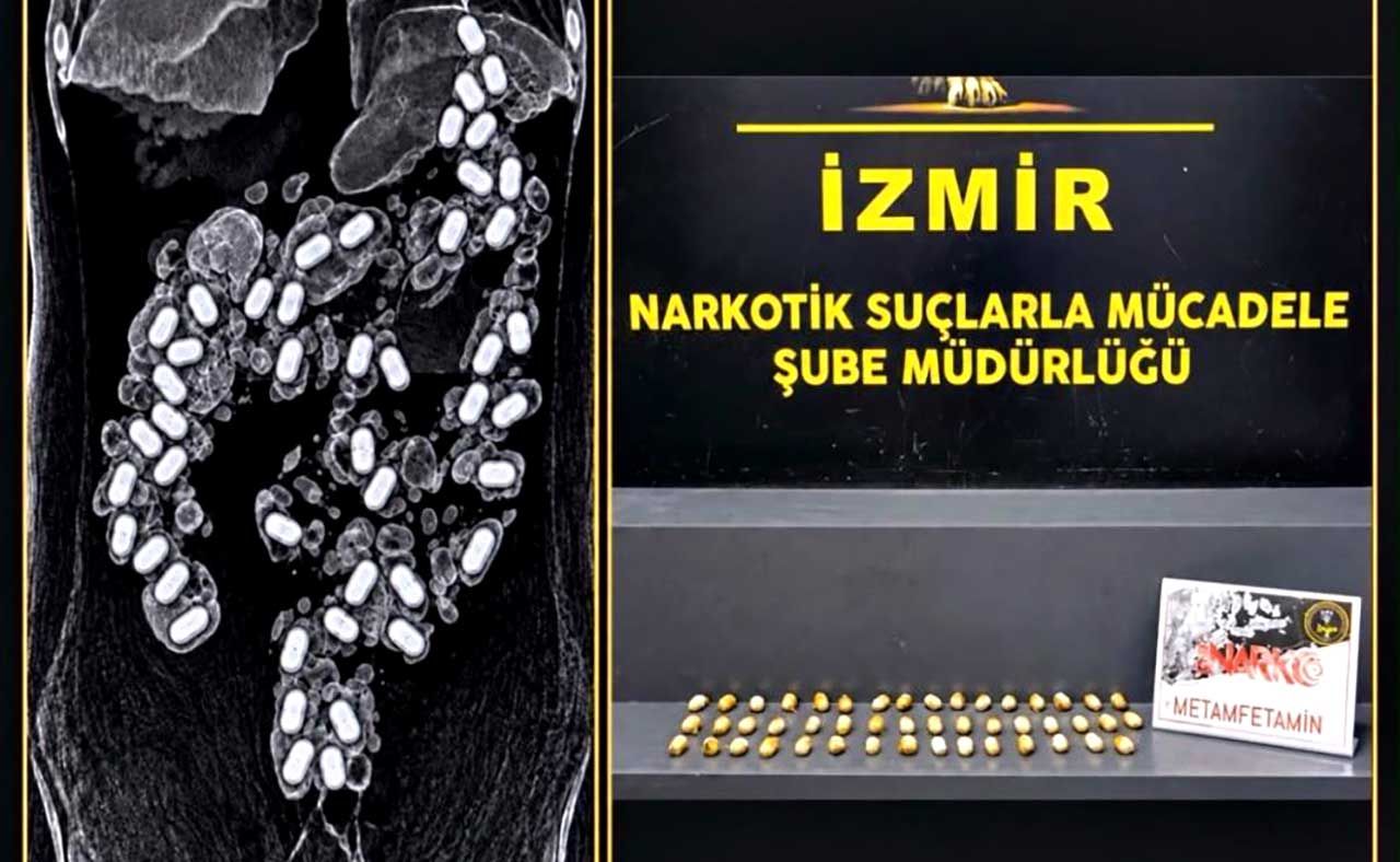 İzmir Havalimanı'nda şok operasyon! Midesinden 47 kapsül çıktı